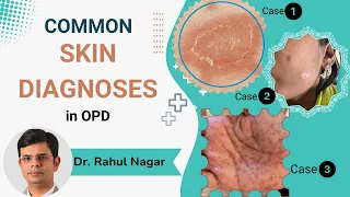 Common Skin Diagnoses In OPD
