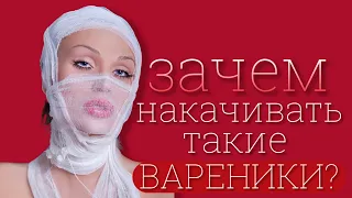 Что я сделала со своим лицом и телом? А также, Саша Шпак как пример неудачных пластических операций