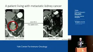 Yale Center for Immuno-Oncology