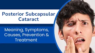 Posterior Subcapsular Cataract: Meaning, Symptoms, Causes, Prevention & Treatment | All about PSC