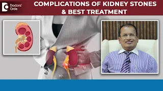 Kidney Stones Pain & Complications | Treatment of Kidney Stone-Dr.Nagarajaiah N | Doctors' Circle