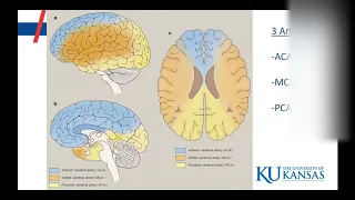 Left vs Right Brain Stroke Symptoms