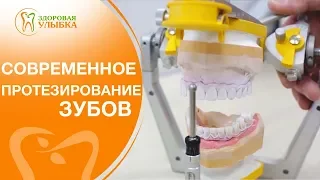 Съемные протезы виды. 😀 О различных видах и фиксации съемных протезов. Здоровая Улыбка. 12+