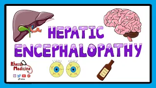 Hepatic Encephalopathy -  Pathophysiology, Stages and West Haven Criteria