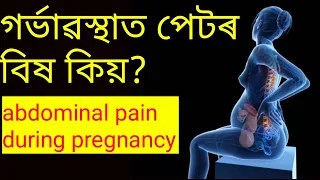 #abdominalPainDuringPregnancy গৰ্ভাৱস্থাত পেটৰ বিষ কিয় #gainknowledge