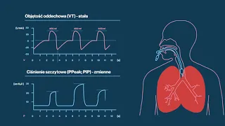 Kurs podstawy inwazyjnej wentylacji mechanicznej pacjentów w przebiegu COVID-19 cz.1
