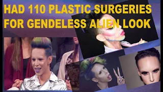 Botched surgery: The Person Who Had 110 Procedures To Transform Into a Genderless Alien