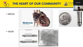 What to Watch for with Atrial Fibrillation with Dr. Zeshan Ahmad M.D.