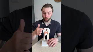 🦷 How a Cavity Works!