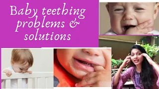 Baby teething relief| process| problems & solutions।pain & relief| bacchon ke dant kab nikalte hain