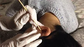 HOW TO GIVE MAJOR ASMR TIINGLES Ear Cleaning Tutorial w. Sticky Q-tips, Wooden Pick (Soft Spoken)