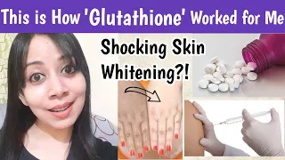 Glutathione Works for Skin Whitening?| For Tan removal, Pigmentations| Glutathione before and after