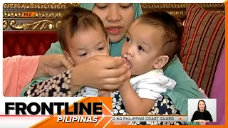 Pinoy conjoined twins, matagumpay ang operasyon sa Saudi Arabia | Frontline Pilipinas