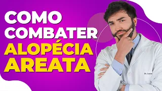 Como Combater Alopécia Areata - Dr Lucas Fustinoni