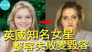 英國女星整容失敗全臉毀容！鼻子塌陷一只眼失明，才49歲卻面目全非【Boogie島】#DanniellaWestbrook