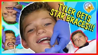 WATCH TYLER GET STAR SHAPED BRACES! | We Are The Davises