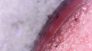 old hot dog under a microscope
