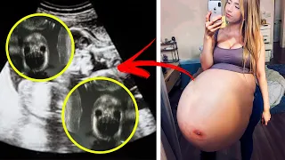 Barriga de Mãe de Aluguel Não Para de Crescer! Médico descobre algo no Ultrassom e DESMAIA!