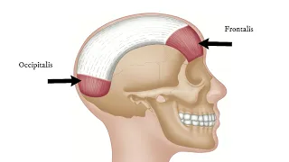 How To Find Trigger Points - Occipitalis (for Tension Headache)