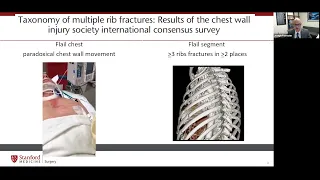 "Surgical Management of Chest Wall Injury" presented by Dr. Joseph Forrester