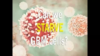 Defeat GBM: Two year plan on how to starve glioblastoma