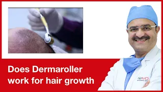 Does Dermaroller work for hair growth | HairMD, Pune