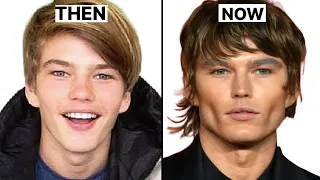 4 Most Common Plastic Surgeries Male Models Get (From a Model)
