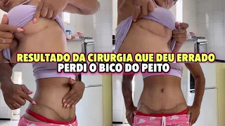 MEU SILICONE QUE DEU ERRADO // MOSTREI TUDO !! NÃO FIQUEI SATISFEITA?