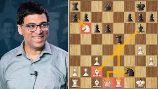 Anand's Immortal #2