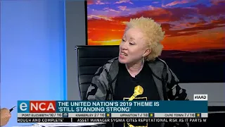 Shining the light on issues faced by people living with albinism