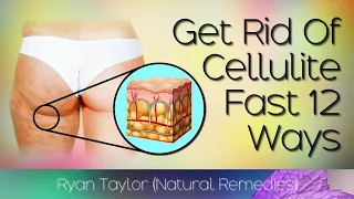 How To Lose Cellulite on Thighs & Bum Fast (Natural Remedies)