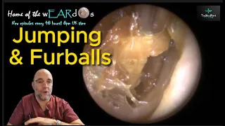 Jumping and Furballs! 220 #ear #earwax #earwaxremoval #earcleaning #asmr #asmrearwax #satisfying