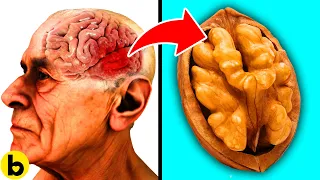 Prevent Alzheimer's & Dementia By Eating These 21 Foods That May Improve Memory