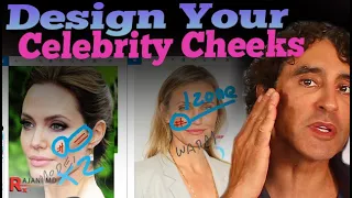 HOW to CREATE BEAUTY // Cheek Fillers and the Cheekbone