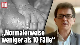 Erster Fall von Affenpocken in Deutschland: Das sind die Symptome | Top-Virologe Klaus Stöhr