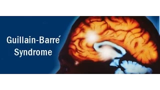 Guillain-Barré syndrome