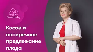 Косое и поперечное предлежание плода | Как перевернуть малыша? Акушер-гинеколог