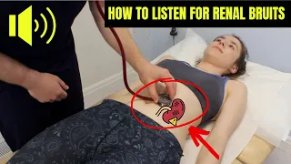 How to auscultate for RENAL BRUITS as seen in Renal Artery Stenosis | Plus example of real sounds...