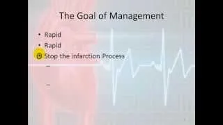 12 Lead Interpretation Part 7: Management of MI