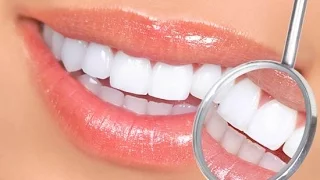 Біла дієта. Якою має бути біла дієта після відбілювання зубів?