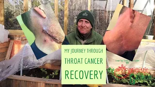 The Optimistic Gardener - My Journey Through Throat Cancer Recovery