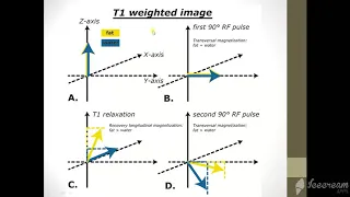 MRI Physics  Part 5 T1 ,T2 and PD اساسيات فيزياء  الرنين المغناظيسي بالعربي