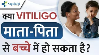 Vitiligo in Babies: क्या Safed Daag माता-पिता से बच्चों में हो सकता है? | Kayakalp Global