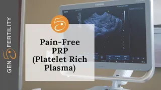 Pain-Free PRP (Platelet Rich Plasma) | Gen 5 Fertility