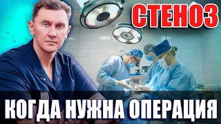 Операция при стенозе - все что нужно знать.Нейрохирург