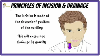 Basic Principles of INCISION and DRAINAGE