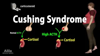 Cushing Syndrome, Animation