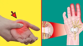7 Reasons Why You Wake Up With Numb Hands 6 Ways to treat numbness in hands