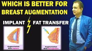 Which is Better Breast Augmentation Fat Transfer or Breast Implants? | Dr. PK Talwar