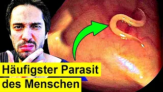 1,5 Milliarden Menschen haben diesen Parasit - Du auch?